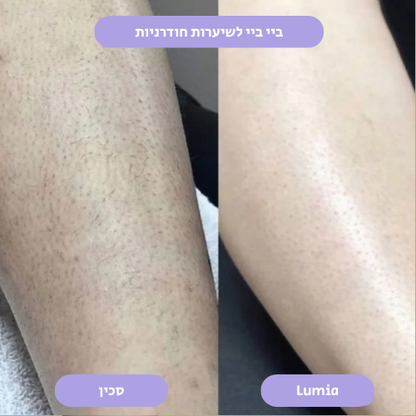 מסיר השיער הקריסטלי של Lumia