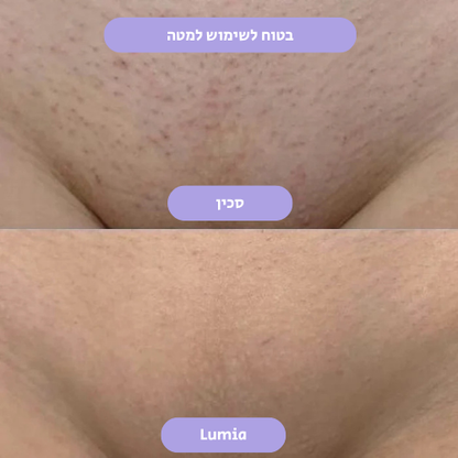 מסיר השיער הקריסטלי של Lumia